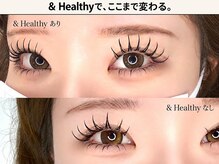 アイリュクス(eyeluxe)