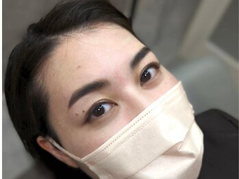 モルフォム(Morphome)/ハリウッドブロウリフト(HBL)