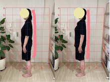 ミノリ(MINORI)/美子宮フェムケア矯正