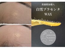 新メニュー白雪プラセンタWAX★産毛&角質除去で憧れ艶肌に！