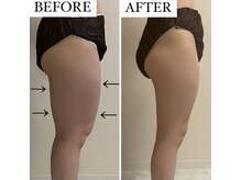 フェミニー(Feminy)/前もものハリが気になる方！