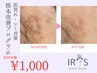 【肌荒れ/シミを繰り返さないために】根本改善プログラム《初回体験¥1,000》