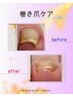 【専任スタッフ施術】巻き爪ケアお試し1本