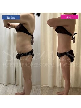 ファウンデーション(FOUNDATION)/痩せたい人必見!