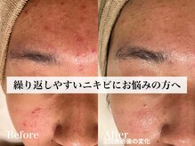 シャルム(Charme)