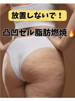 ヨサパーク リノ(YOSA PARK Lino)の写真/セルフケアではなかなか落としずらい！冷えて硬い箇所No.1！頑固な脂肪に集中攻撃！脱下半身太り☆