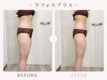 パールプラス 日立店(Pearl plus)/通常の痩身と違う、驚きの効果♪
