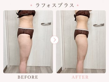 パールプラス 日立店(Pearl plus)/通常の痩身と違う、驚きの効果♪