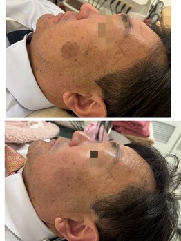 プリエール ビューティの写真/シミ・毛穴・ニキビ・肌トラブルを徹底攻略!男の肌悩みを本気で改善へ