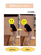いみすぽ整体/50代男性ビフォアアフター
