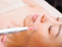 エー(a)/毛穴汚れゴッソリ