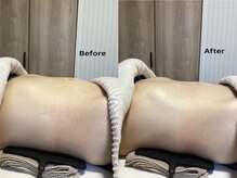 オリス(ORRIS)/腸揉みデトックス