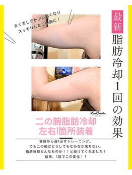 ヒーリングリゾート ナゴミ(Nagomi)/脂肪冷却◆二の腕コース