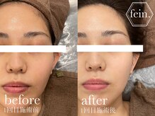 フェイン 青山店(fein.)/水分の入れ込み重視！