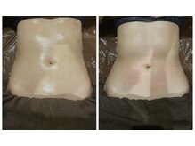 ソラウミ(SORAUMI)/1回でも効果を実感！