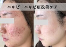 エピア 半田店(Epia)