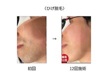 サロン ド クラール(salon de curar)の雰囲気（【ひげ脱毛】毛の状態、痛みに合わせたよりそう脱毛）