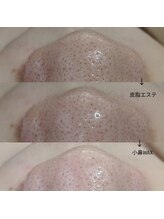 メンズプシュケ(men's PSYCHE)/