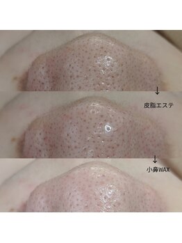 メンズプシュケ(men's PSYCHE)/