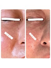 アンレーブ(an'reve)/【エアジェット5回目】