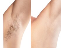 ポノピピ(ponopipi)の雰囲気（メンズヒゲ脱毛(全身脱毛)大歓迎脱毛の7割が男性です！）