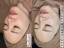 ビジュー(bijoux)の雰囲気（全大阪でもレアなW施術での効果は一度でヤミツキ女優肌に！）