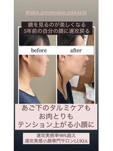 ルキア(LUKIA)/5年前の私に諦めないでください