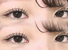 メル(Mel.)/バインドロック80束♪