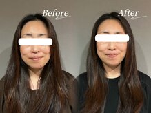 ソア(Soa)/リフトアップ脳解放スパ