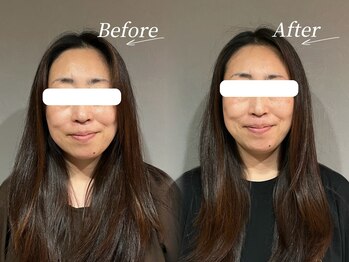 ソア(Soa)/リフトアップ脳解放スパ