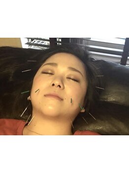 小顔になりたい