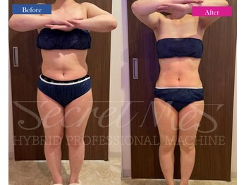 ファウンデーション(FOUNDATION)/