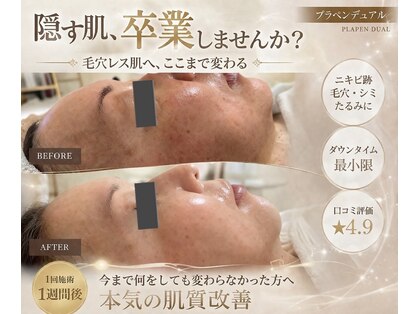 ジャスミン(Jasmin)の写真