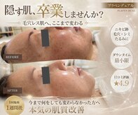 ジャスミン(Jasmin)