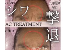 メゾン ド エム(maison de M)の雰囲気（素肌を見るのが嬉しくなる！褒められ肌を作る幹細胞エステ!!）