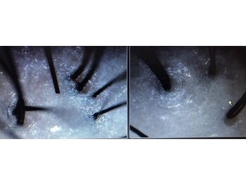 シルフ エルスパ 阪急茨木店(Sylph &EirSPA)/