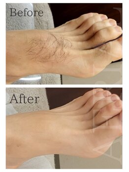 エアリアル 大牟田店/人気部位です！