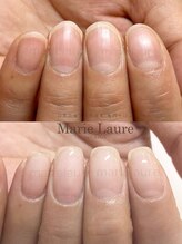 マリーロール 淀屋橋本店(Marie Laure)/自爪育成/深爪矯正/ネイルケア