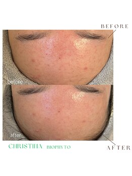 シェア(share.)/クリスティーナ　ビオフィート