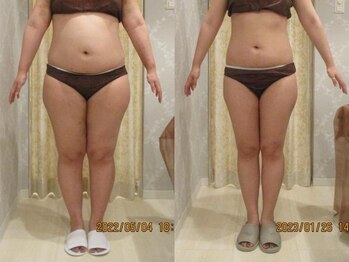 プロラボスパ 倉敷店/30代前半　症例写真