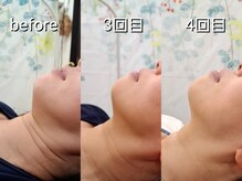 アイオンラッシュ(Aion Lash)/レモンボトル