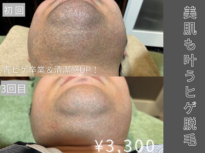 アシュレ リル 西多賀店(assure Lilou)の写真