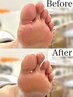 【FOOT】ネイルケア＋足裏角質ケア ¥9,300
