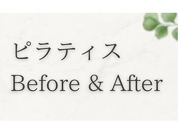 エヌアンドエヌ鍼灸院 福住店(N&えぬ鍼灸院)/ピラティス Before & After
