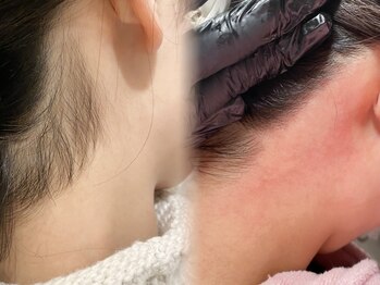 ミーククル(MEKUKURU)/うなじワックス