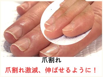 広島深爪専門ネイルサロン ナッカ/