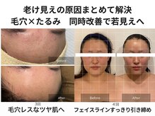 ラナン パラフューズ(Ranun's PARAFUSE.)