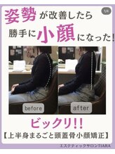 ティアラ(TIARA)/まるごと小顔矯正　1回の効果