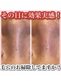ホワイトアクア 甲府店(WHITEAQUA) 毛穴洗浄とピーリング即効性抜群です!