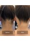 オベリオ(Oberio)の写真/全身脱毛でツルスベ美肌に♪丁寧なカウンセリングと施術で脱毛デビューの方にもおすすめ☆メンズ脱毛もOK!